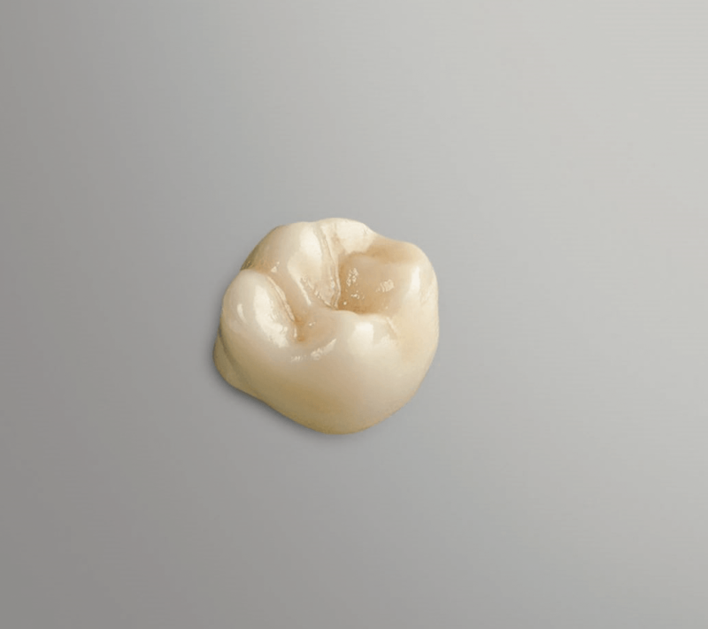 CEREC® pack Sérénité – Image 9